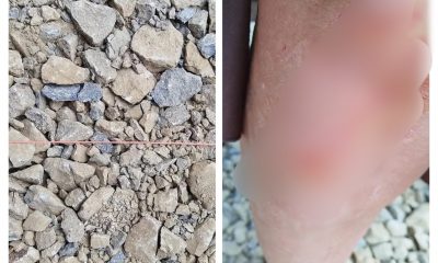 O clujeancă și-a nenorocit genunchiul, după ce s-a împiedicat în șantierul de pe strada Universității - FOTO