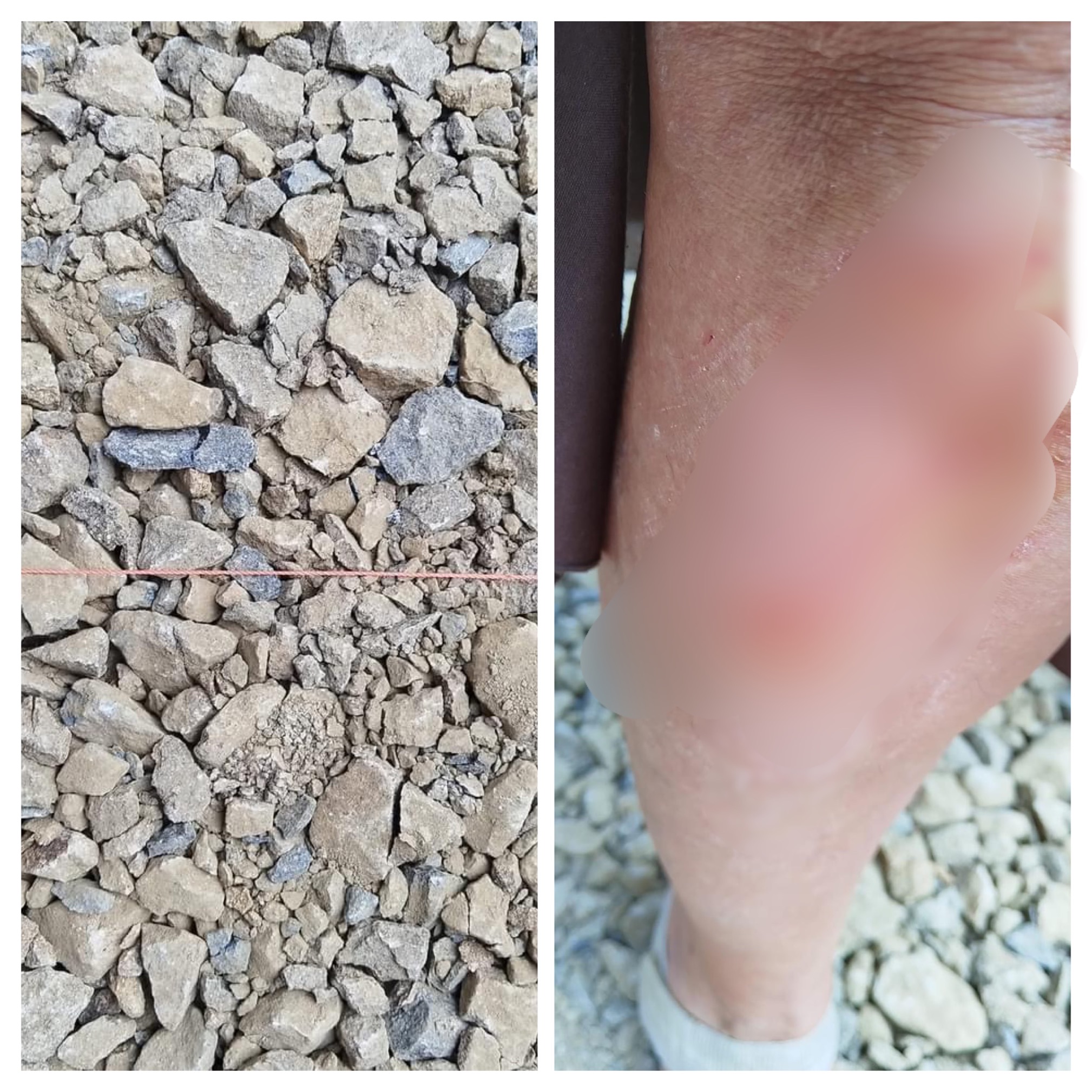 O clujeancă și-a nenorocit genunchiul, după ce s-a împiedicat în șantierul de pe strada Universității - FOTO