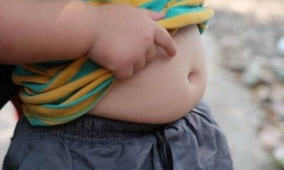 1 din 3 copii din România este supraponderal sau obez. Medic: "Este mai mult o problemă emoțională decât alimentară"